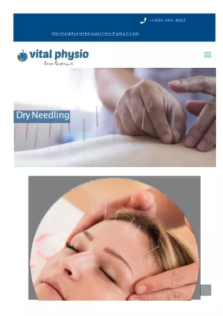 Dry Needling Services in Surrey, BC