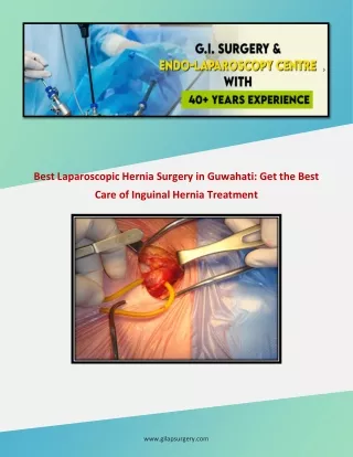 Inguinal Hernia Treatment In Guwahati: Achieving Optimal Surgical Outcomes