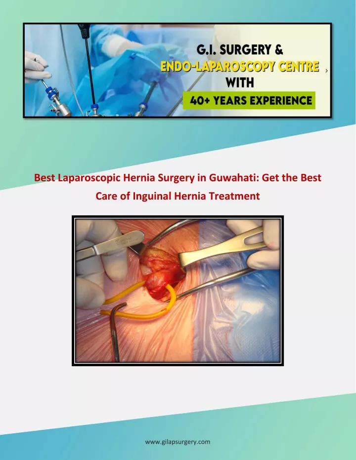 best laparoscopic hernia surgery in guwahati