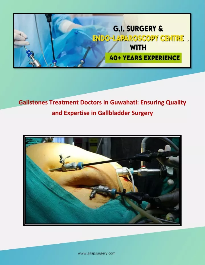 gallstones treatment doctors in guwahati ensuring