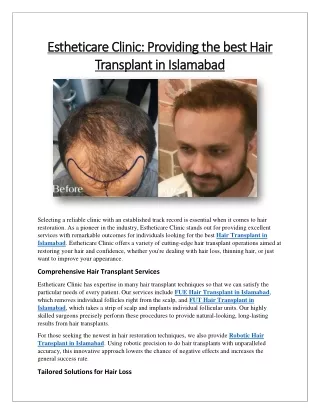 Estheticare Clinic Providing the best Hair Transplant in Islamabad