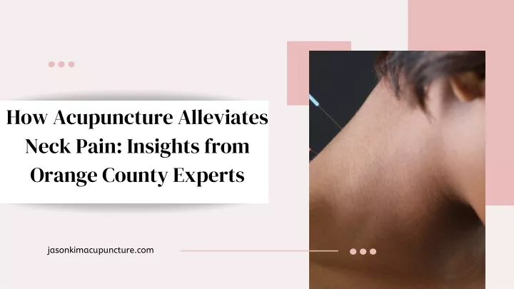 how acupuncture alleviates neck pain insights