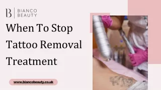 When To Stop Tattoo Removal Treatment?