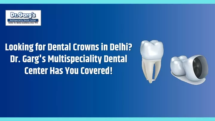 looking for dental crowns in delhi dr garg