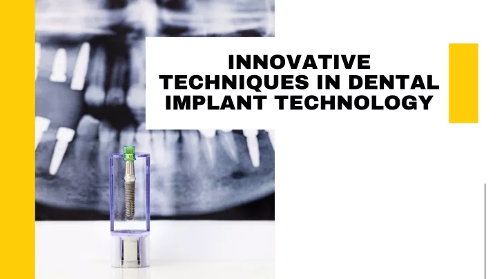 innovative techniques in dental implant technology