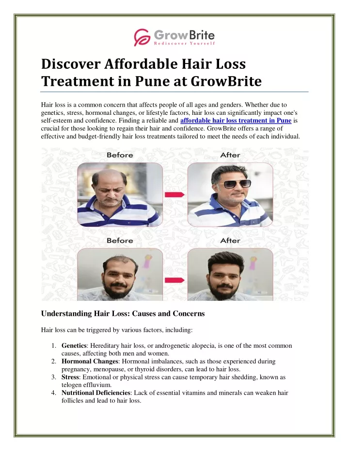 discover affordable hair loss treatment in pune