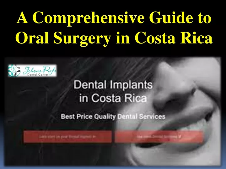 a comprehensive guide to oral surgery in costa