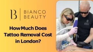 How Much Does Tattoo Removal Cost in London?