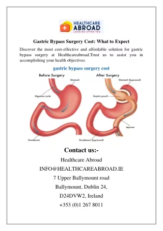 Gastric Bypass Surgery Cost What to Expect