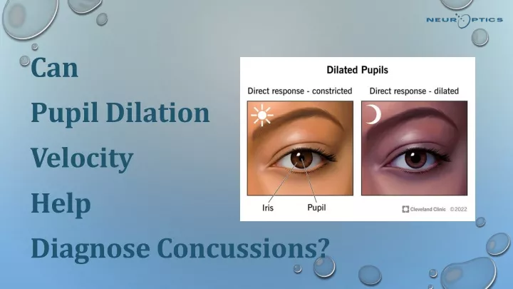 can pupil dilation velocity help diagnose