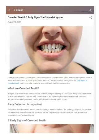 Crowded Teeth 5 Early Signs You Shouldn't Ignore