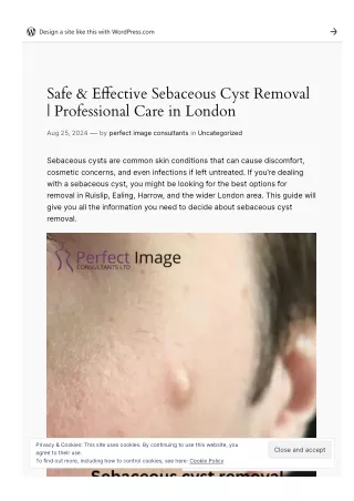 Safe & Effective Sebaceous Cyst Removal | Professional Care in London