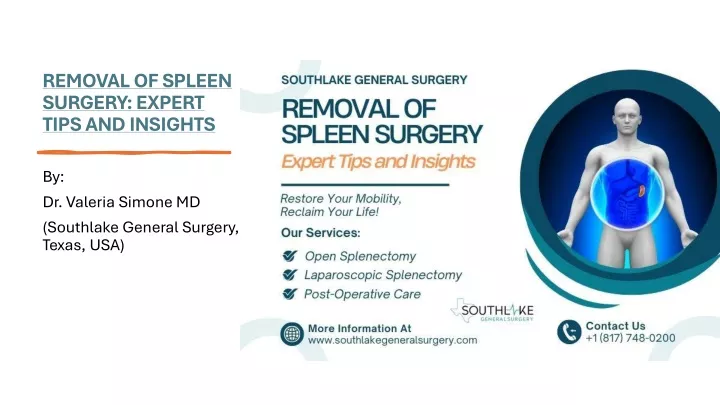 removal of spleen surgery expert tips and insights