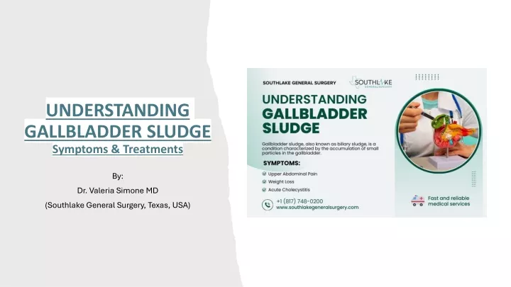 understanding gallbladder sludge symptoms