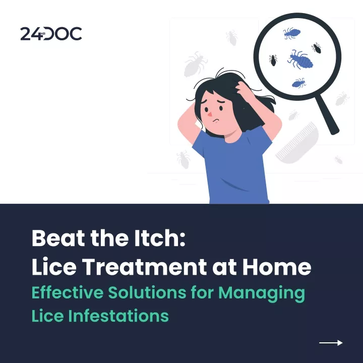 beat the itch lice treatment at home effective