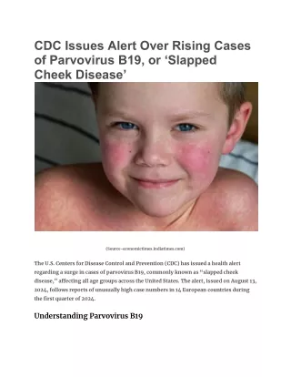 CDC Issues Alert Over Rising Cases of Parvovirus B19, or ‘Slapped Cheek Disease’