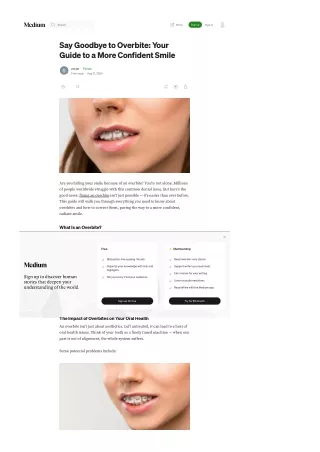 Say Goodbye to Overbite Your Guide to a More Confident Smile