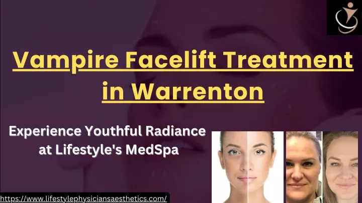 vampire facelift treatment in warrenton