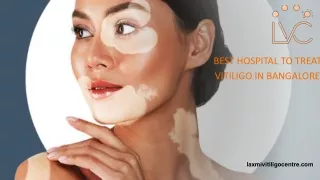 Best Hospital to Treat Vitiligo in Bangalore