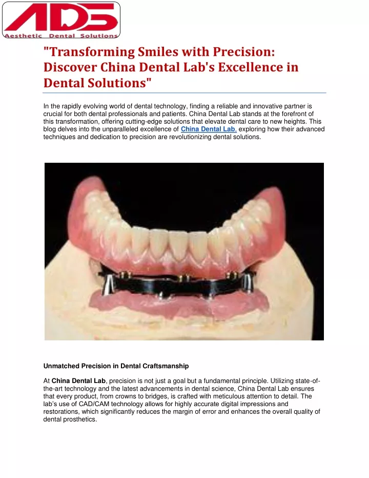 transforming smiles with precision discover china