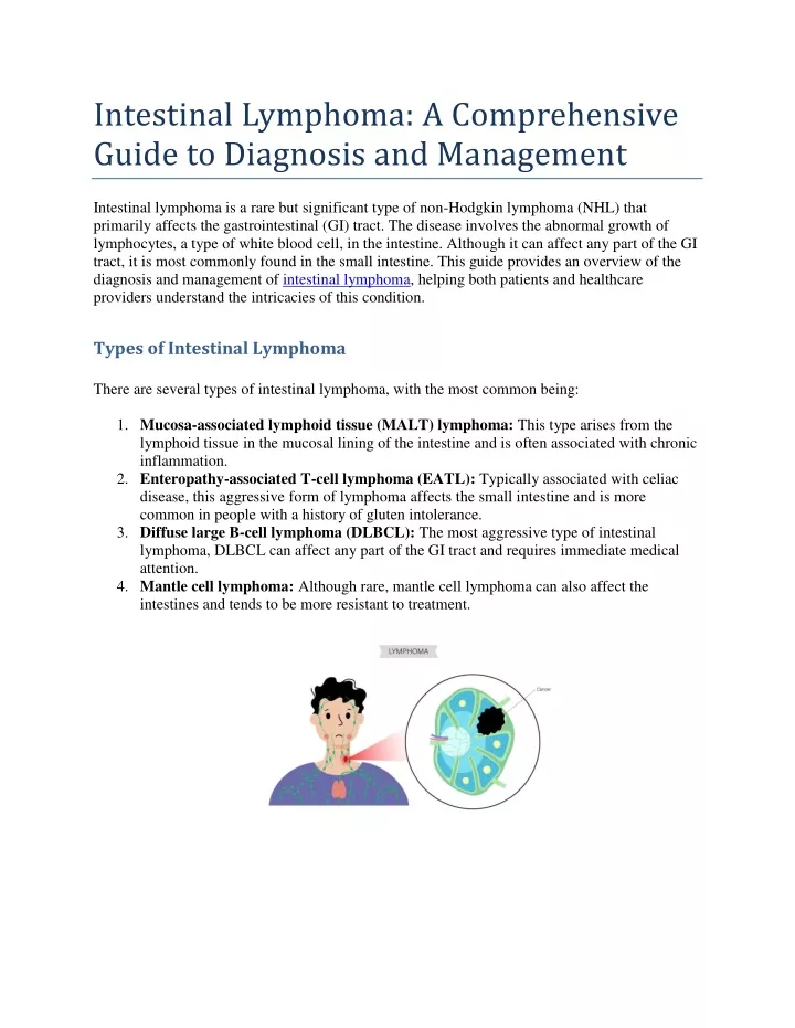 intestinal lymphoma a comprehensive guide