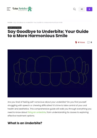 Say Goodbye to Underbite Your Guide to a More Harmonious Smile