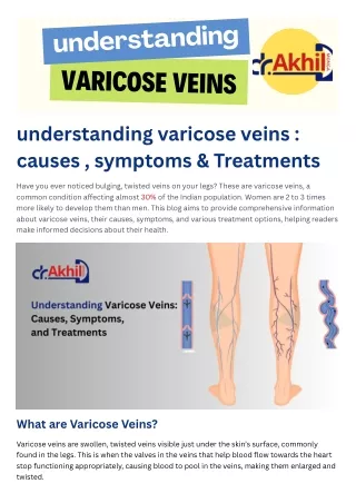 understanding varicose veins  causes , symptoms & Treatments