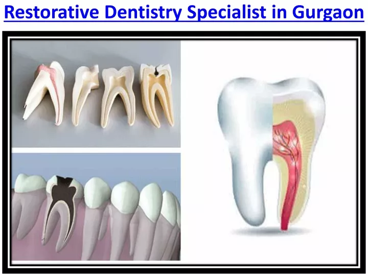 restorative dentistry specialist in gurgaon