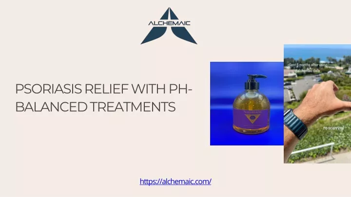 psoriasis relief with ph balanced treatments