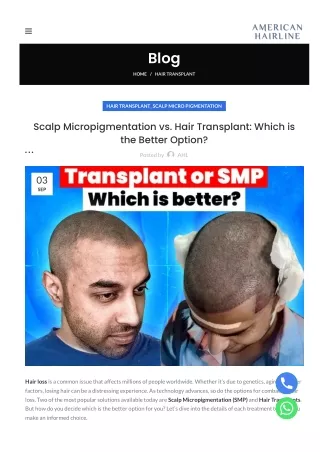 Scalp-Micropigmentation vs. Hair Transplant Which is the Better-Option