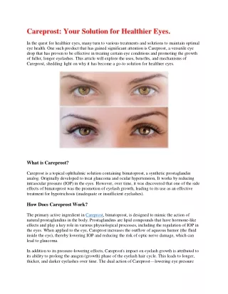 Careprost article.