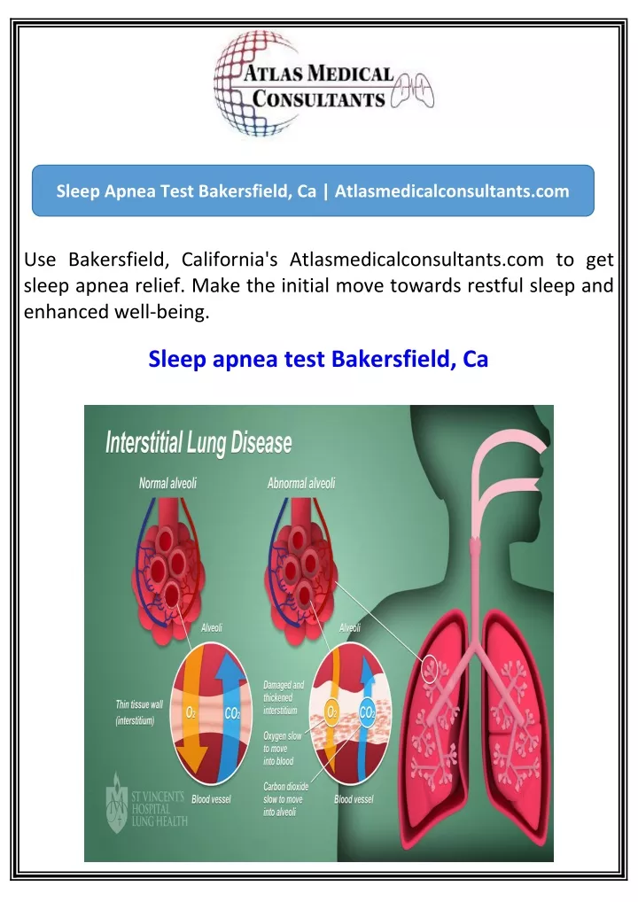 sleep apnea test bakersfield