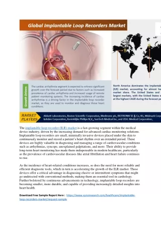 Global Implantable Loop Recorders Market: Growth, Trends, and Forecasts to 2030
