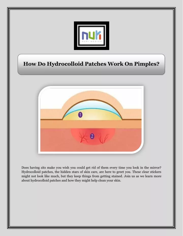 how do hydrocolloid patches work on pimples