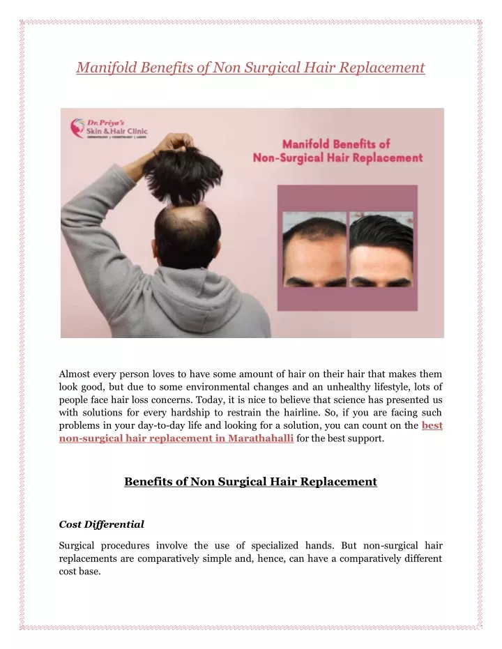 manifold benefits of non surgical hair replacement