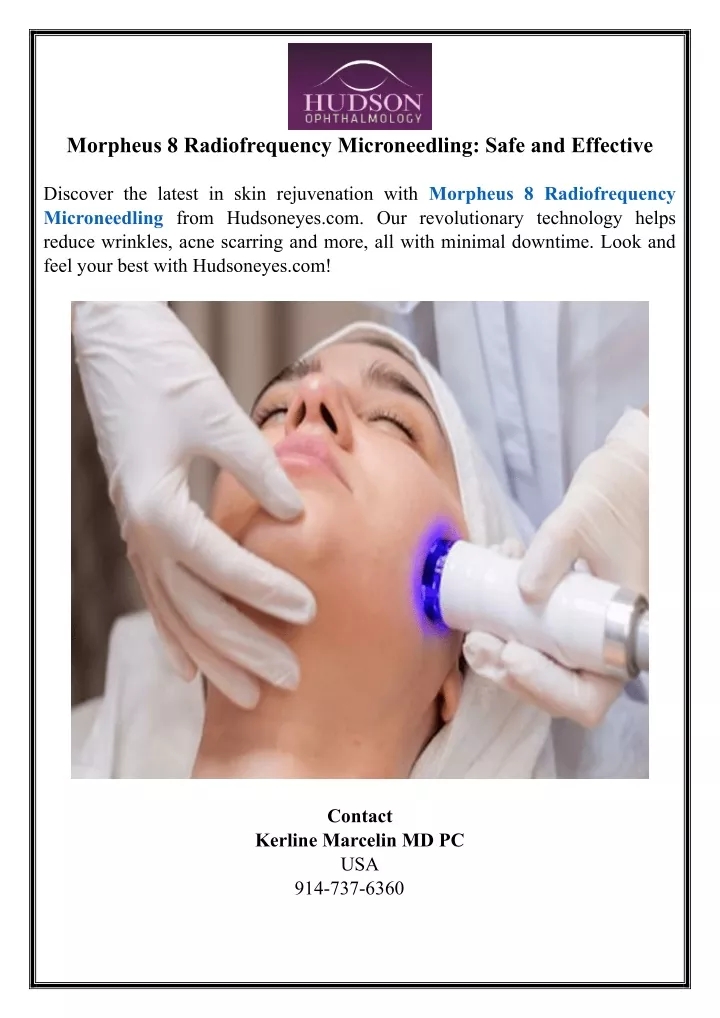 morpheus 8 radiofrequency microneedling safe