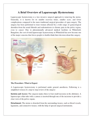 A Brief Overview of Laparoscopic Hysterectomy