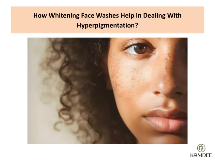 how whitening face washes help in dealing with hyperpigmentation