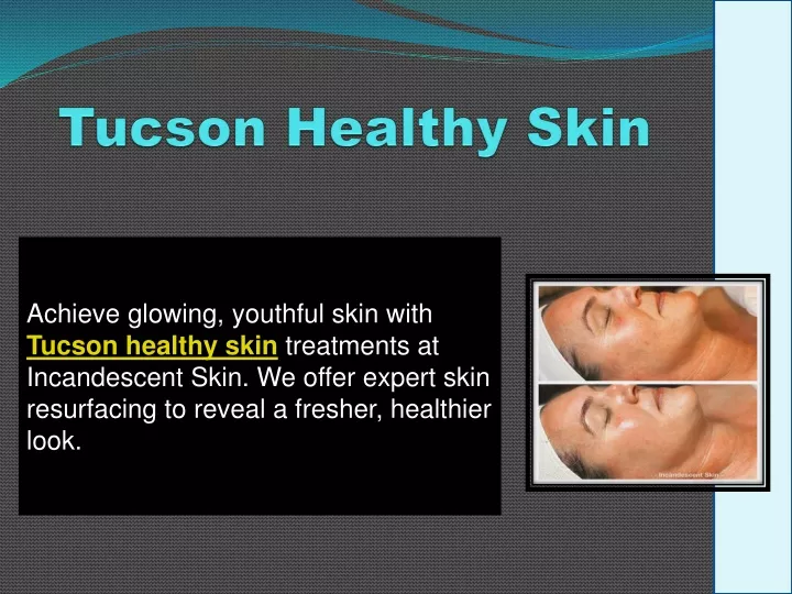 tucson healthy skin