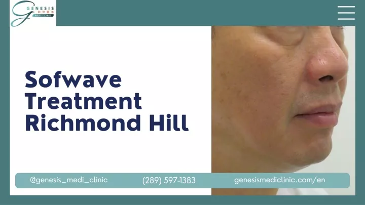 sofwave treatment richmond hill