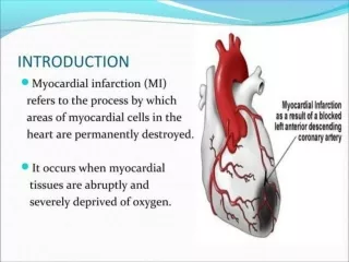 Pharmacotherapeutics of Myocardial Infarction
