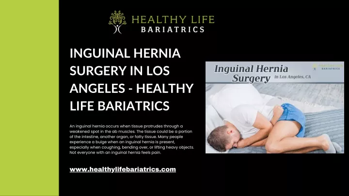 inguinal hernia surgery in los angeles healthy