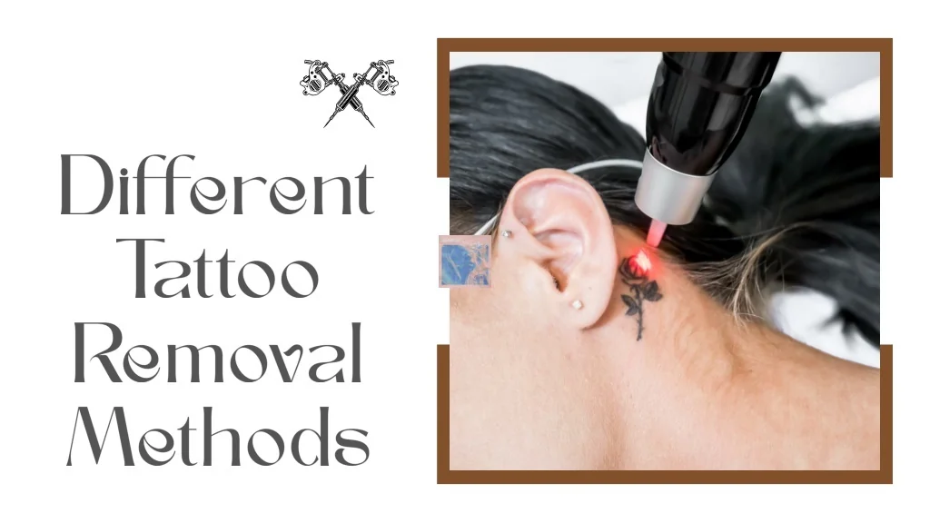 PPT - Different Tattoo Removal Methods PowerPoint Presentation, free ...