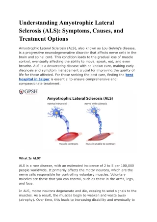 Understanding Amyotrophic Lateral Sclerosis (ALS)_ Symptoms, Causes, and Treatment Options