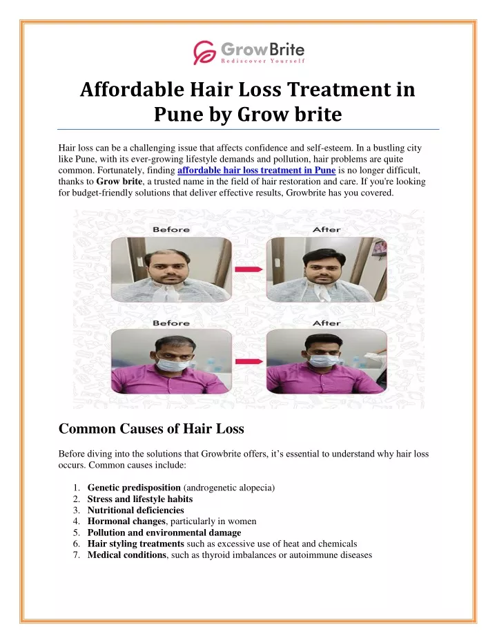 affordable hair loss treatment in pune by grow