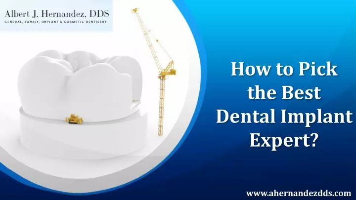 how to pick the best dental implant expert