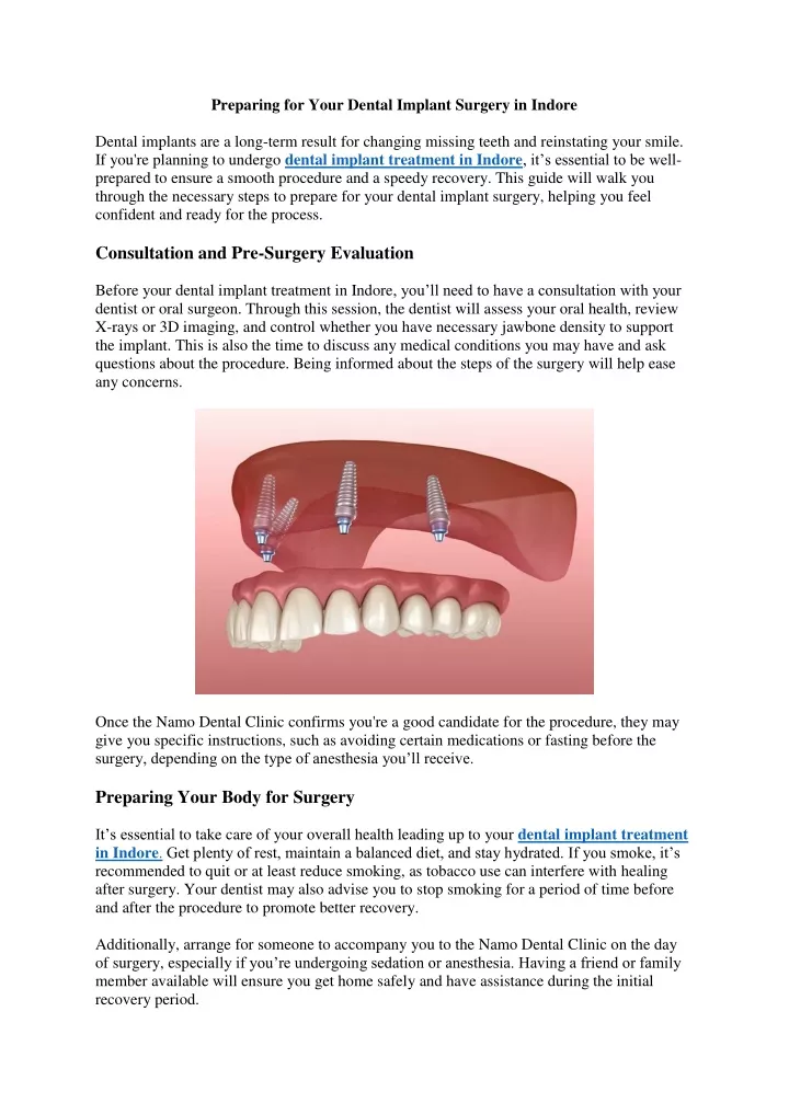 preparing for your dental implant surgery