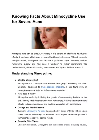 knowing facts about minocycline use for severe