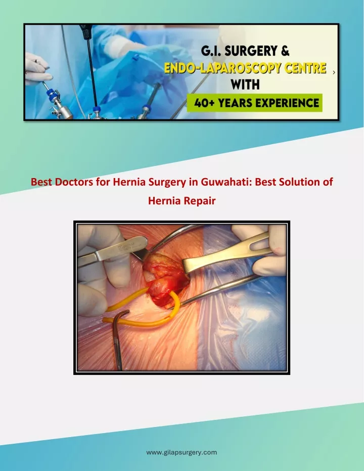 best doctors for hernia surgery in guwahati best