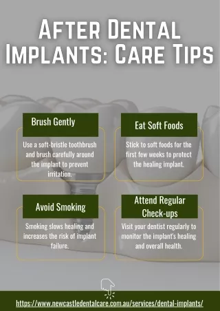 After Dental Implants: Care Tips